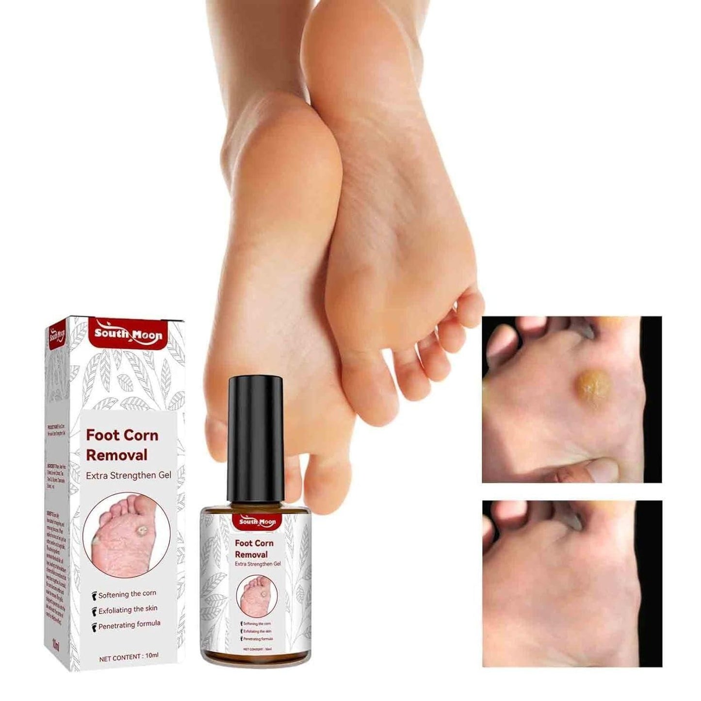 Foot Corn Removal Serum 30ml ( Pack Of 1 )