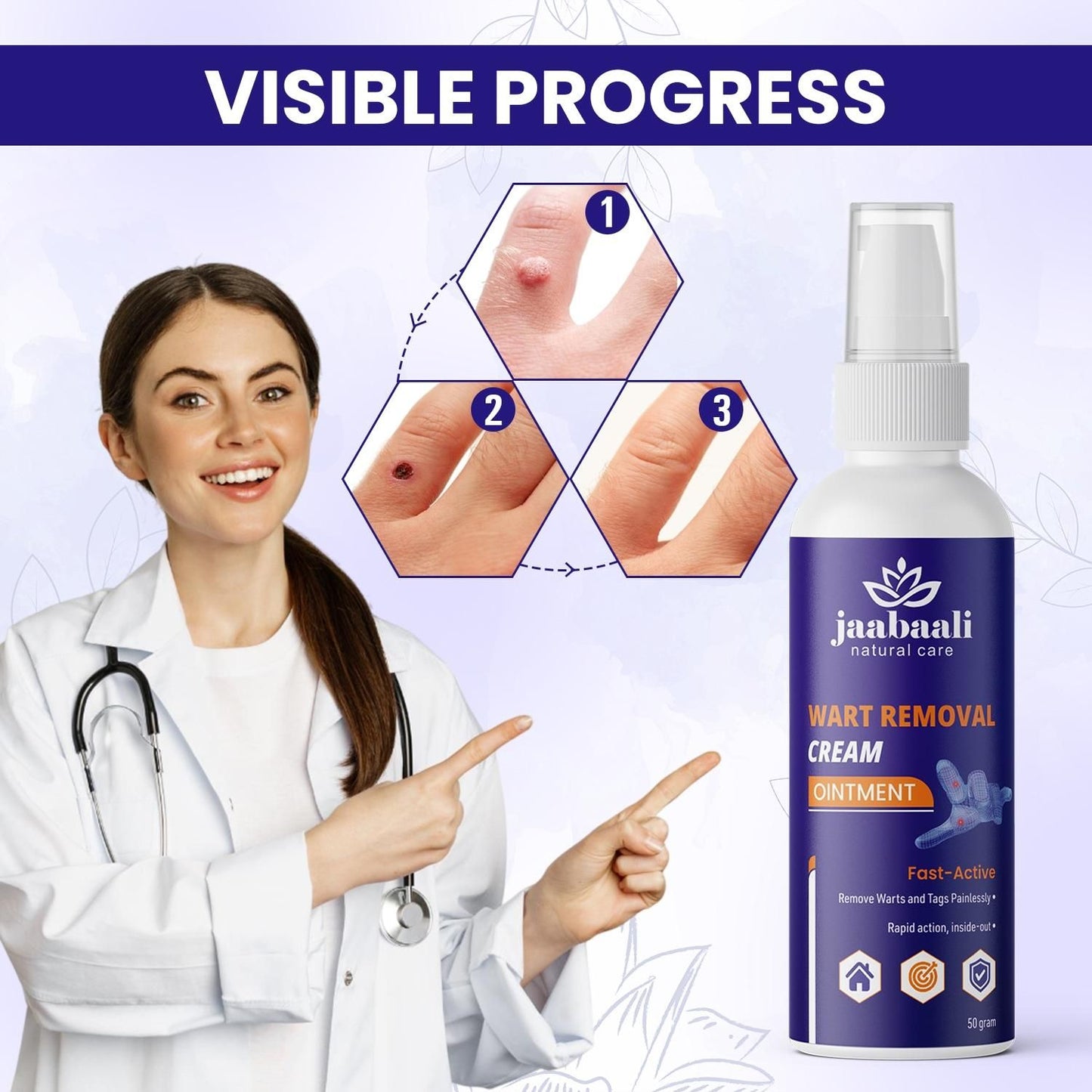 Wart Remover Cream