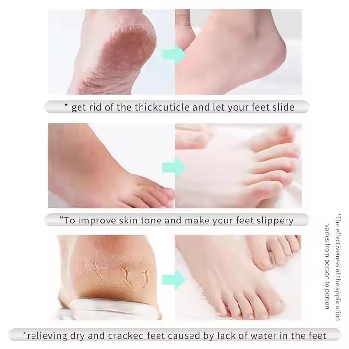 Exfoliating Foot Mask Normal