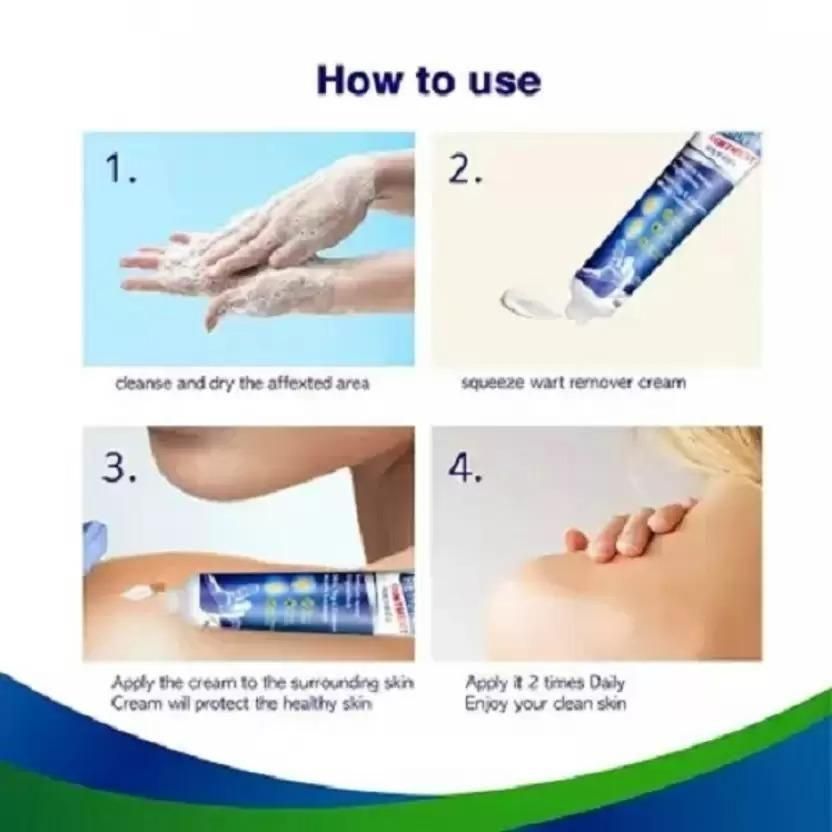 WartsOff Instant Blemish Removal Cream Pack of 1