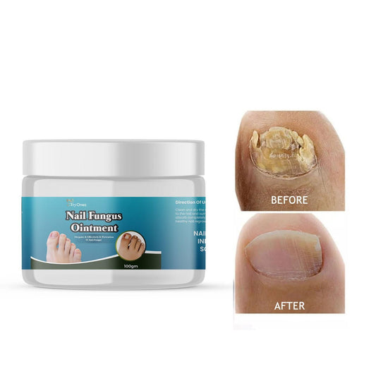 TryOnes Nail Fungus Ointment 100gram