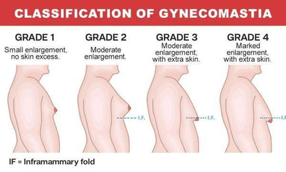 Luhaka Gynecomastia Cream - Chest Fat Burner