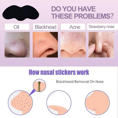 Deep Cleansing Blackhead Remover Strips (Pack of 10)