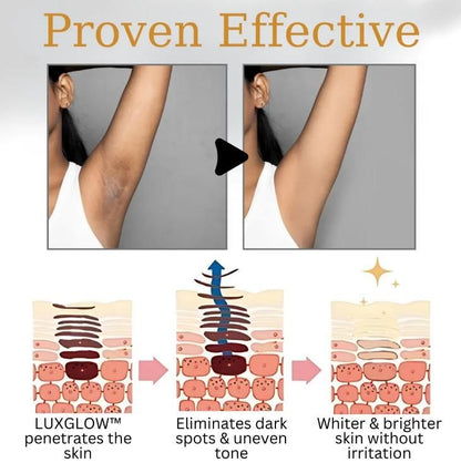 Luxglow Body Whitening Cream 100 ml Pack of 1