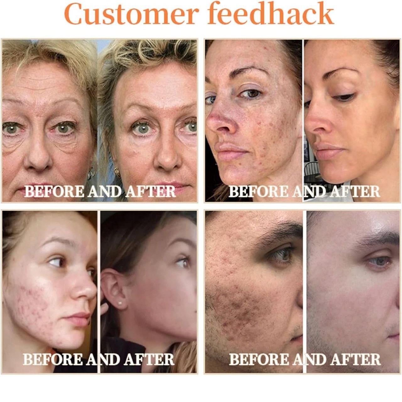 Garagelaine Horse Oil Therepy Cream 120gm Pack of 1