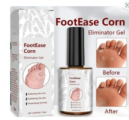 Foot Corn Removal Serum 30ml ( Pack Of 1 )