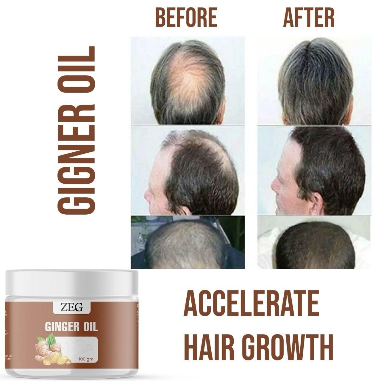 ZEG GINGER OIL 100GM ? 100% Natural Multipurpose Oil for Hair, Skin & Body (Pack of 2)