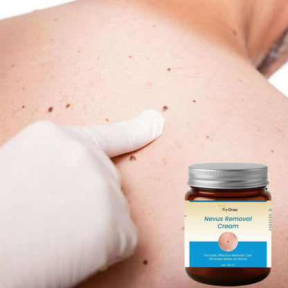 Nevus Removal Cream 200 ml Pack of 2