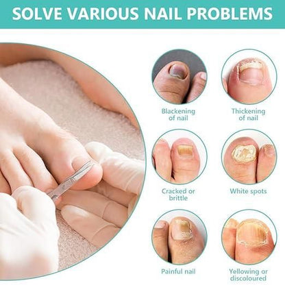 Nail Nurture Bee Venom 60 ml Pack of 2