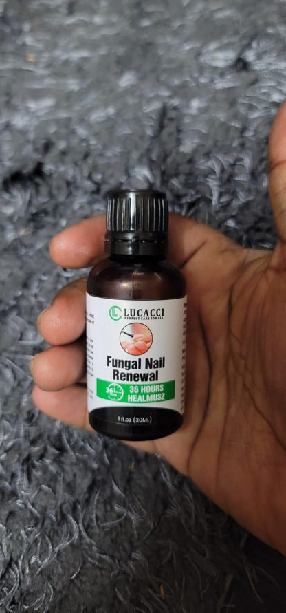 Fungal Nail Renewal 30Ml (Pack of 2)