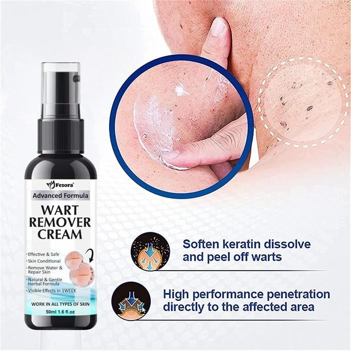 Fezora  Wart Remover Ointment, Wart Remover Cream (50ml) (Pack of 2)