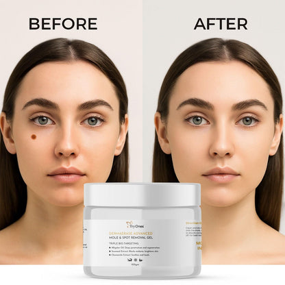 Mole and Spot Removal Gel 100 gm Pack of 1