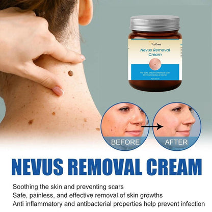 Nevus Removal Cream 100 ml Pack of 1