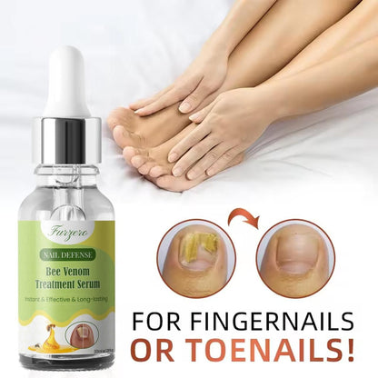 Furgero Nail Defense Bee Venom Treatment Serum 30ml(Pack Of 2)