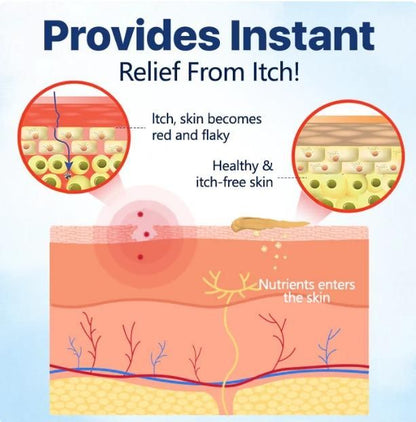 EASEITCH Genital Soothing Cream 50g(Pack Of 2)