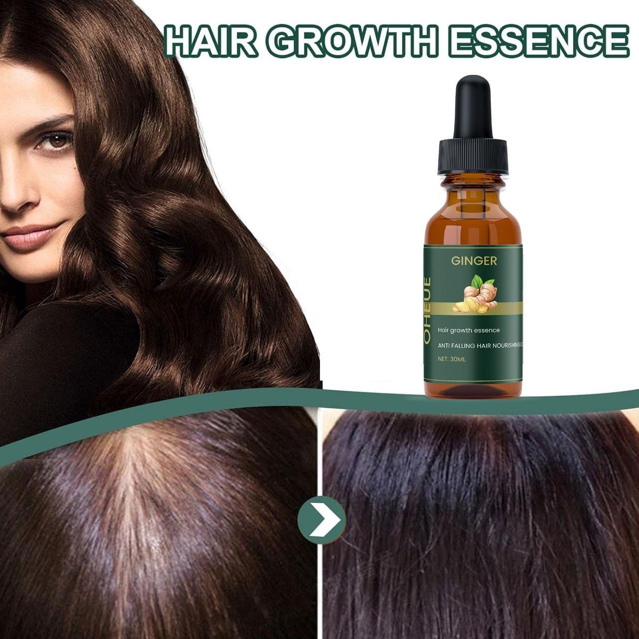 Ginger Hair Growth Essence 30ML Pack of 1