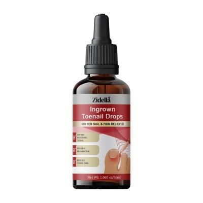 Zidella Ingrown Toenail Drops ? Soften Nail & Pain Reliever (30ml) (Pack of 1)