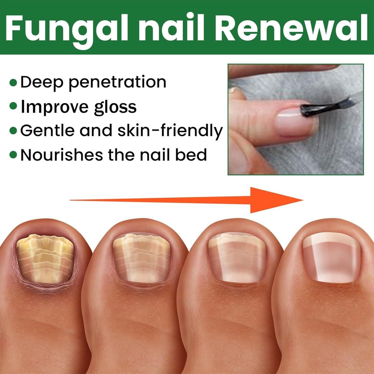Fungal Nail Renewal 30Ml (Pack of 2)