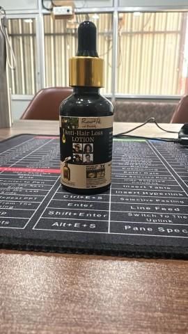 Rootandremedy Anti-Hair Loss Lotion Serum for hair Growth and stop hair fall-30ML (Pack of 2pcs)