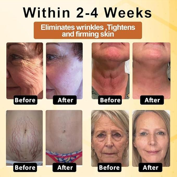 Botox Bee Advanced Multi-Action Firming Cream 100 gm Pack of 1