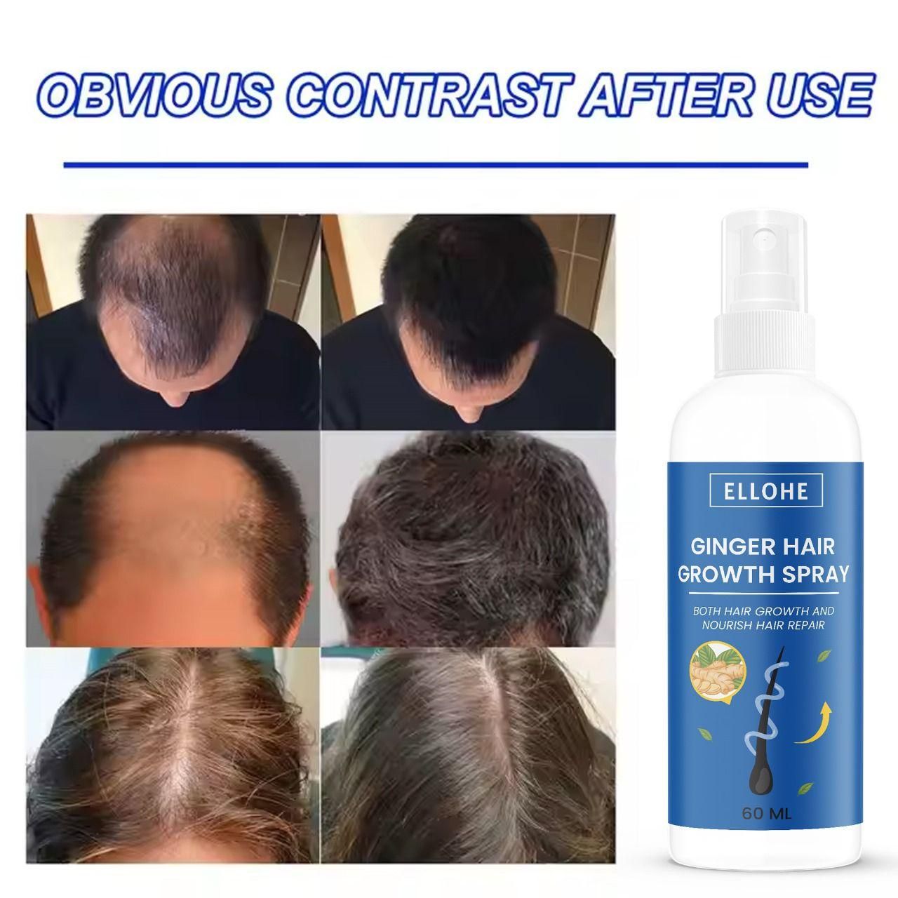 Ellohe Ginger Hair Growth Spray 60 ML Pack of 1