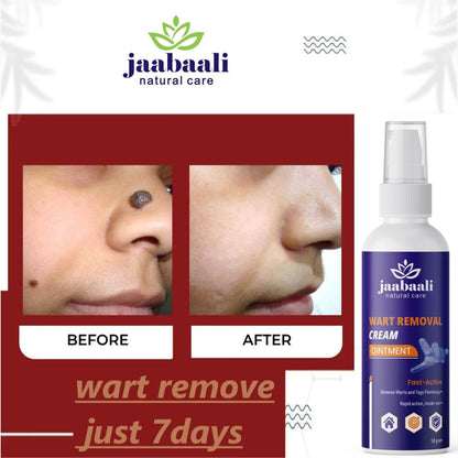 Wart Remover Cream