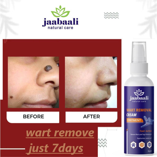 Wart Remover Cream