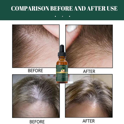 Ginger Hair Growth Essence 30ML Pack of 1